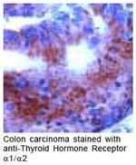 THRA Antibody in Immunohistochemistry (IHC)