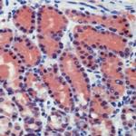Caspase 8 Antibody in Immunohistochemistry (IHC)