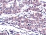 TNFR2 Antibody in Immunohistochemistry (IHC)