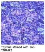 TNFR2 Antibody in Immunohistochemistry (IHC)