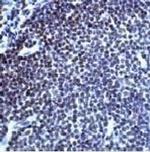 TOP2B Antibody in Immunohistochemistry (Paraffin) (IHC (P))