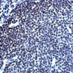 TOP2B Antibody in Immunohistochemistry (IHC)