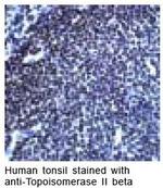 TOP2B Antibody in Immunohistochemistry (IHC)