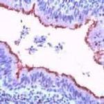 beta Tubulin Antibody in Immunohistochemistry (Paraffin) (IHC (P))