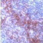 CD138 Antibody in Immunohistochemistry (Frozen) (IHC (F))