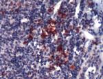 CD138 Antibody in Immunohistochemistry (IHC)