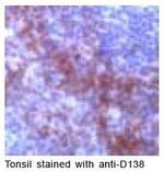 CD138 Antibody in Immunohistochemistry (IHC)