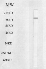 HSL Polyclonal Antibody