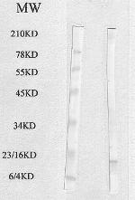 FABP4 Polyclonal Antibody