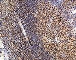 IL-22 Antibody in Immunohistochemistry (Paraffin) (IHC (P))