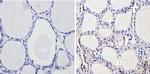 THRB Antibody in Immunohistochemistry (Paraffin) (IHC (P))