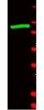 beta Galactosidase Antibody in Western Blot (WB)