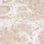 SNX1 Antibody in Immunohistochemistry (Paraffin) (IHC (P))