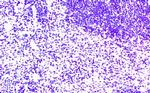 CCR7 Polyclonal Antibody