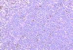 CCRD6 Polyclonal Antibody