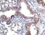 CCR11 Polyclonal Antibody