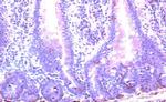 CCR10 Antibody in Immunohistochemistry (Paraffin) (IHC (P))