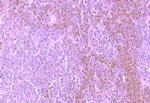 CCR8 Antibody in Immunohistochemistry (Paraffin) (IHC (P))