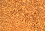 CCR2 Antibody in Immunohistochemistry (Paraffin) (IHC (P))