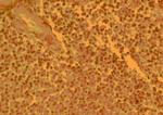 CCR4 Polyclonal Antibody