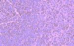 CCR5 Polyclonal Antibody
