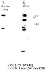 p63 Antibody in Western Blot (WB)