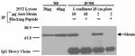 Menin Antibody in Western Blot (WB)