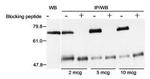 Menin Antibody in Western Blot (WB)