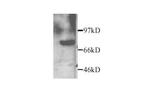 MMP2 Polyclonal Antibody