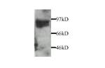 MMP9 Polyclonal Antibody