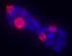 Gli1 Antibody in Immunocytochemistry (ICC/IF)