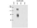 Gli1 Antibody in Western Blot (WB)