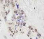 STAT6 Antibody in Immunohistochemistry (Paraffin) (IHC (P))