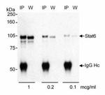 STAT6 Antibody in Western Blot (WB)