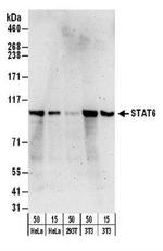 STAT6 Antibody in Western Blot (WB)