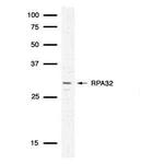 RPA2 Antibody in Western Blot (WB)