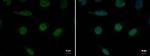 XPB Polyclonal Antibody