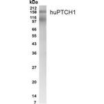 PTCH Polyclonal Antibody