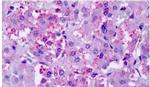 CHRM2 Antibody in Immunohistochemistry (Paraffin) (IHC (P))