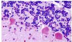 CHRM2 Antibody in Immunohistochemistry (Paraffin) (IHC (P))