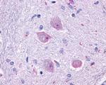 CHRM4 Antibody in Immunohistochemistry (Paraffin) (IHC (P))