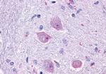 CHRM4 Antibody in Immunohistochemistry (Paraffin) (IHC (P))
