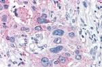 XPR1 Antibody in Immunohistochemistry (Paraffin) (IHC (P))