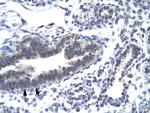 CDK7 Antibody in Immunohistochemistry (Paraffin) (IHC (P))