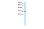 CDK7 Antibody in Western Blot (WB)