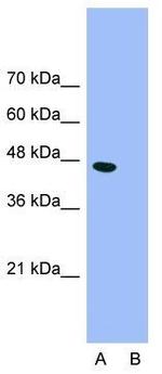 GABRP Antibody in Western Blot (WB)