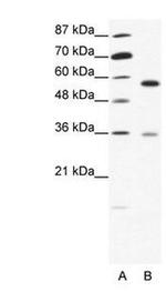 GDI1 Antibody in Western Blot (WB)