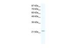 RGS10 Antibody in Western Blot (WB)