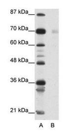 HSP90 beta Antibody in Western Blot (WB)