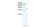 c-Fos Antibody in Western Blot (WB)